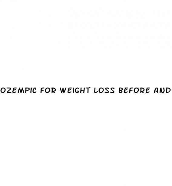 ozempic for weight loss before and after