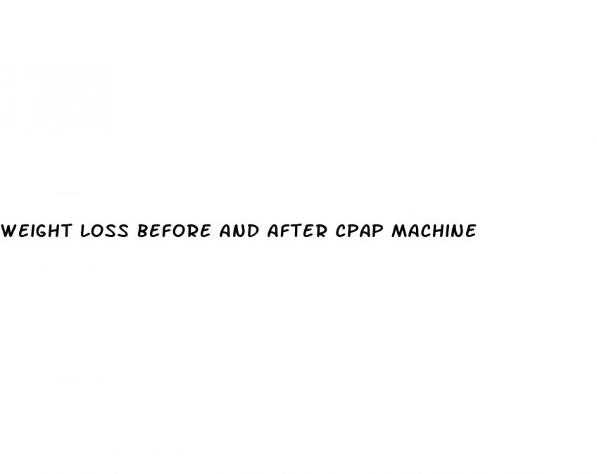 weight loss before and after cpap machine