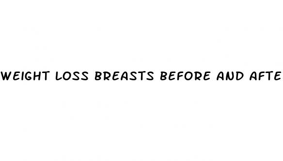 weight loss breasts before and after