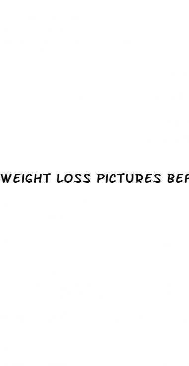 weight loss pictures before and after
