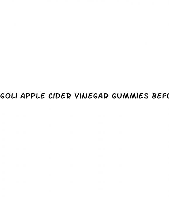 goli apple cider vinegar gummies before and after