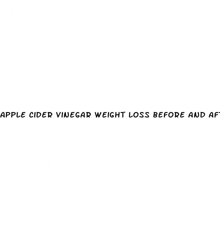 apple cider vinegar weight loss before and after