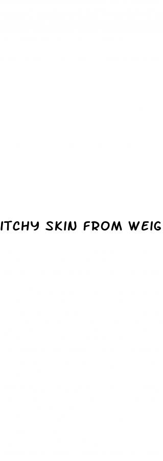 itchy skin from weight loss