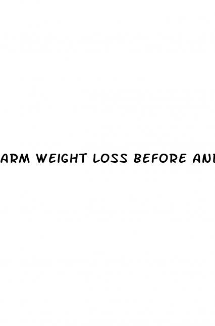 arm weight loss before and after