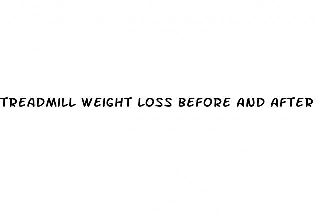 treadmill weight loss before and after