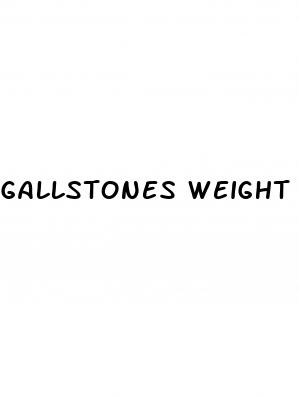 gallstones weight loss
