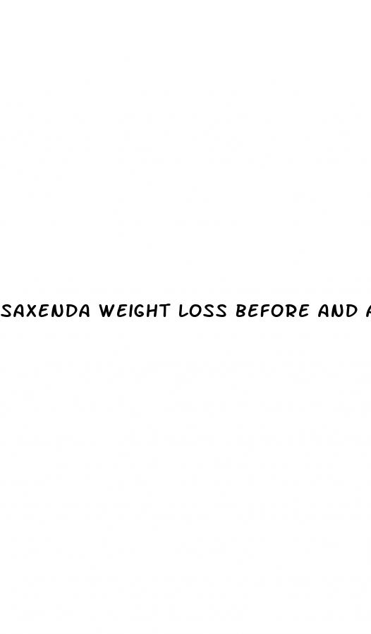 saxenda weight loss before and after