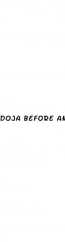 doja before and after weight loss