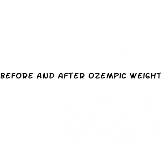 before and after ozempic weight loss