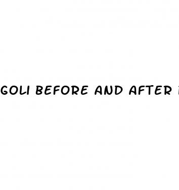 goli before and after pictures