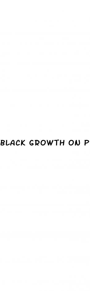 black-growth-on-penis