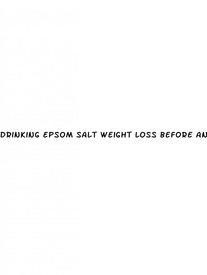 Drinking Epsom Salt Weight Loss Before And After - ﻿Công Ty TNHH Phát